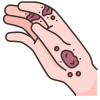 Allergy Treatment in Bhandup by dr pouloomee das