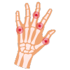 Arthritis Treatment in Bhandup by dr pouloomee das